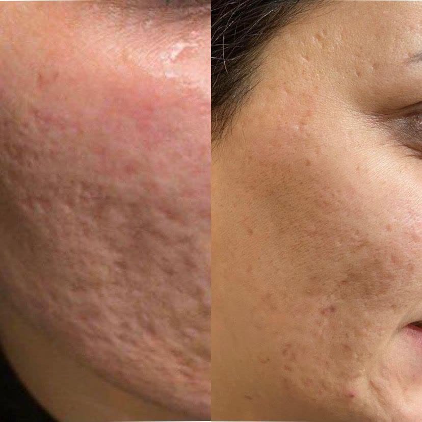 پاکسازی پوست در قزوین